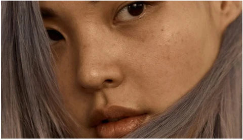 does sex cause breakouts?