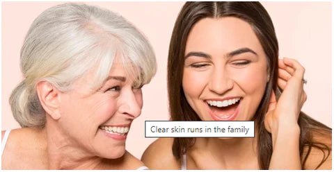 clear skin runs in the family