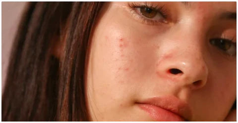 what's going on with my skin?