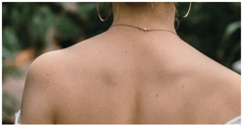 bacne 101: how to clear up backside breakouts