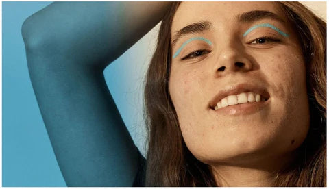 i’ve got acne prone skin, now what?