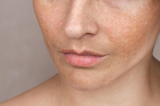 Uneven Skin Tone Products