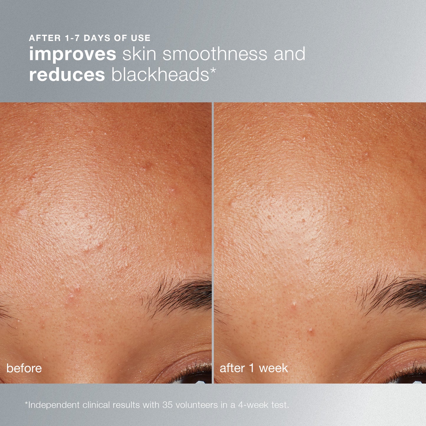 daily microfoliant exfoliator