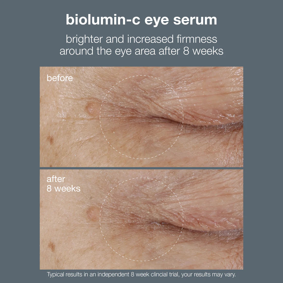 biolumin-c vitamin c eye serum