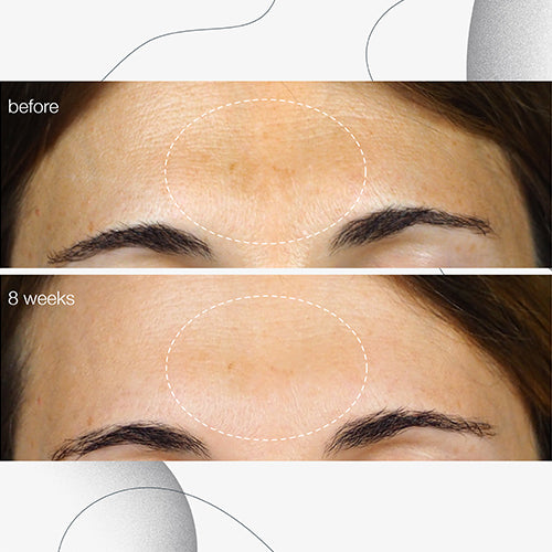powerbright dark spot serum