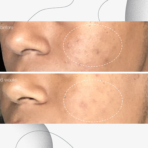powerbright dark spot serum