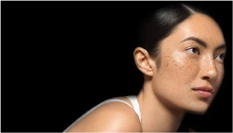 myths about oily skin