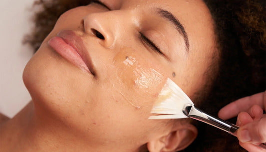 skin treatments for teens