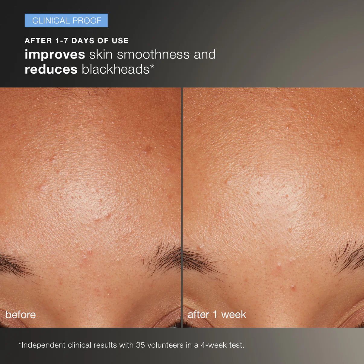daily microfoliant exfoliator