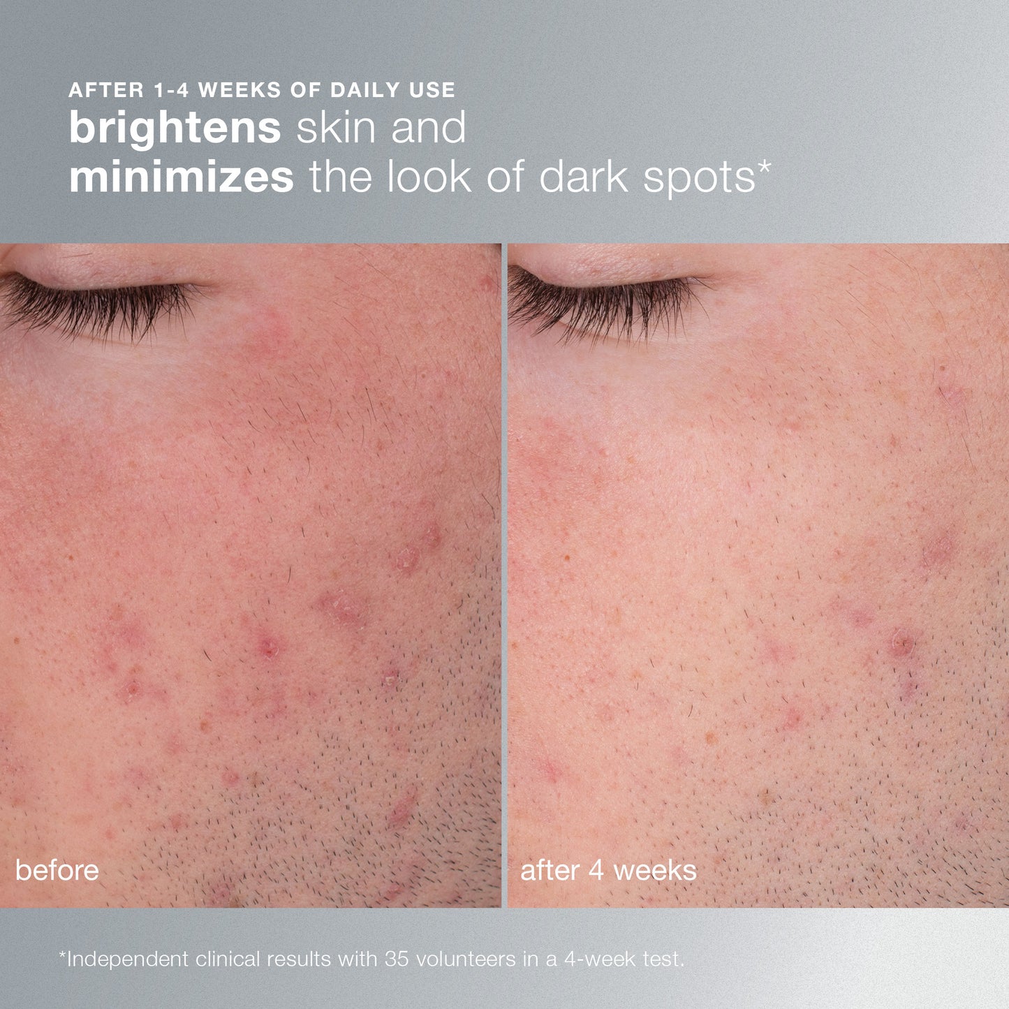 daily microfoliant exfoliator