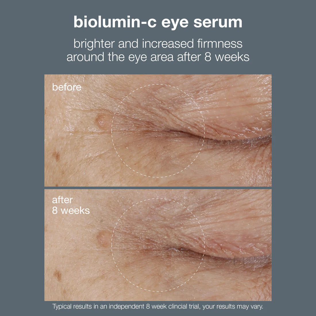 biolumin-c eye serum