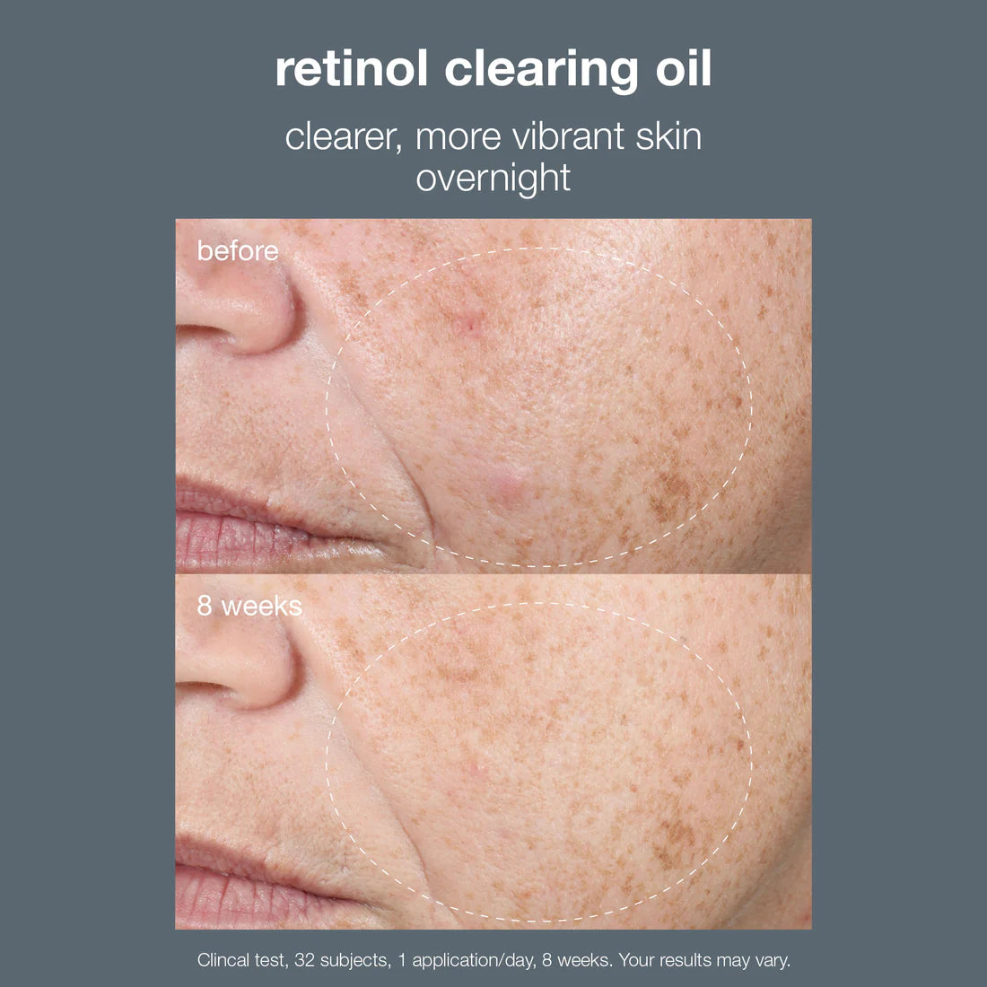 retinol clearing oil